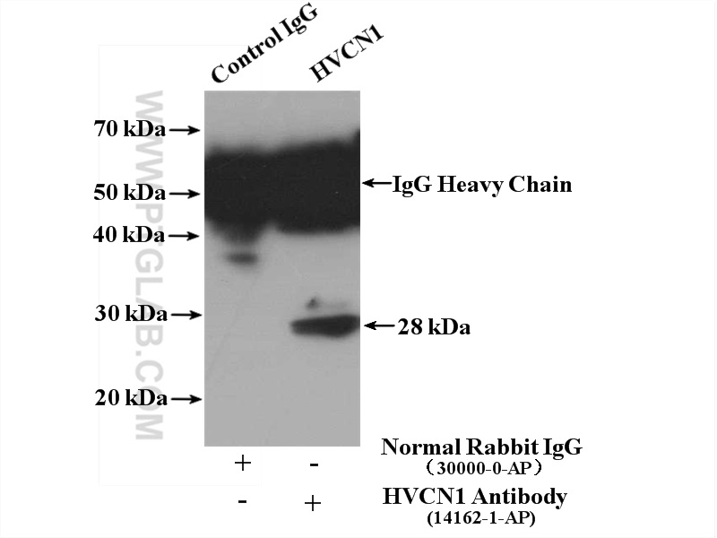 IP experiment of PC-3 using 14162-1-AP