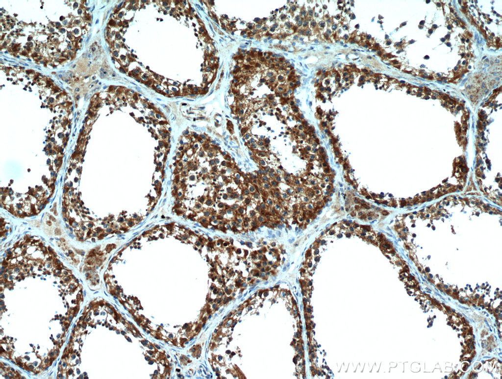 IHC staining of human testis using 19625-1-AP