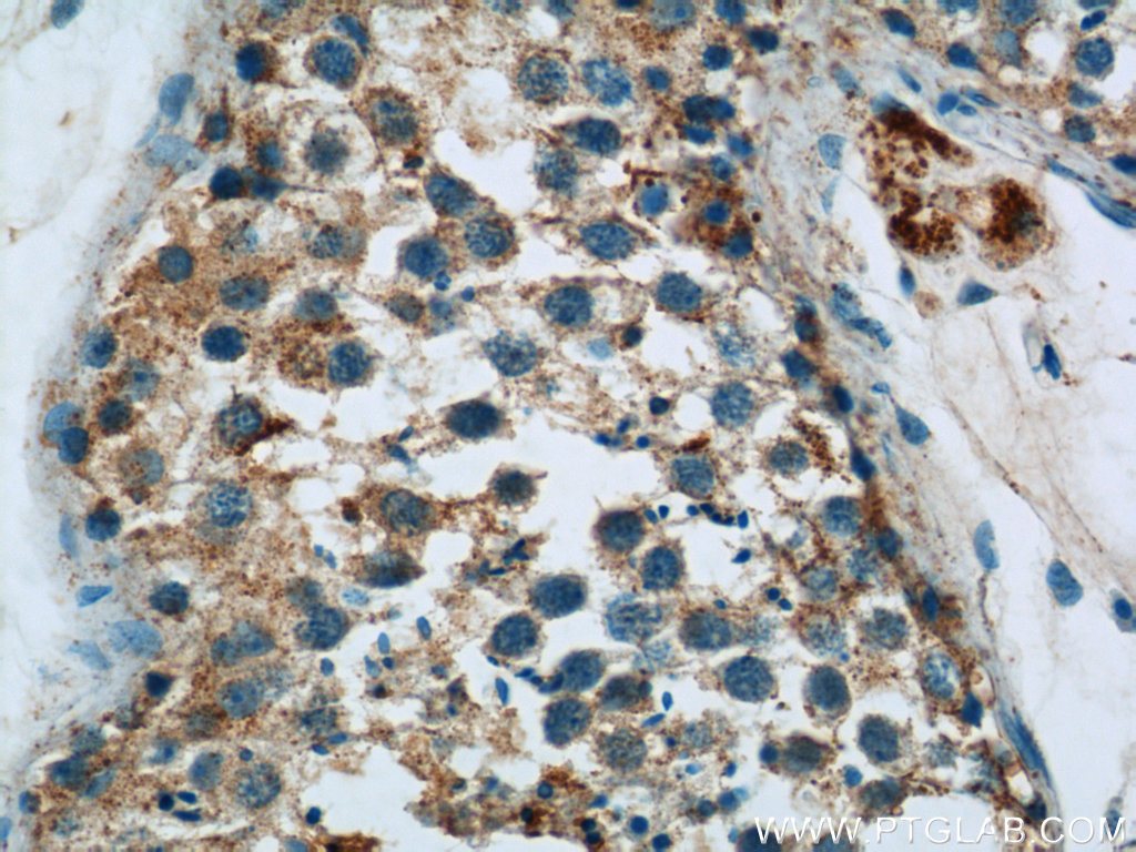 IHC staining of human testis using 18139-1-AP