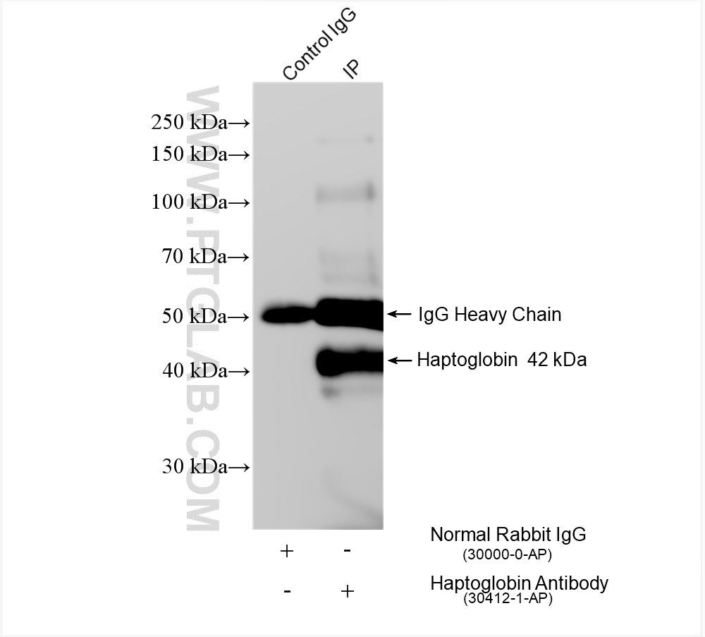 IP experiment of human plasma using 30412-1-AP