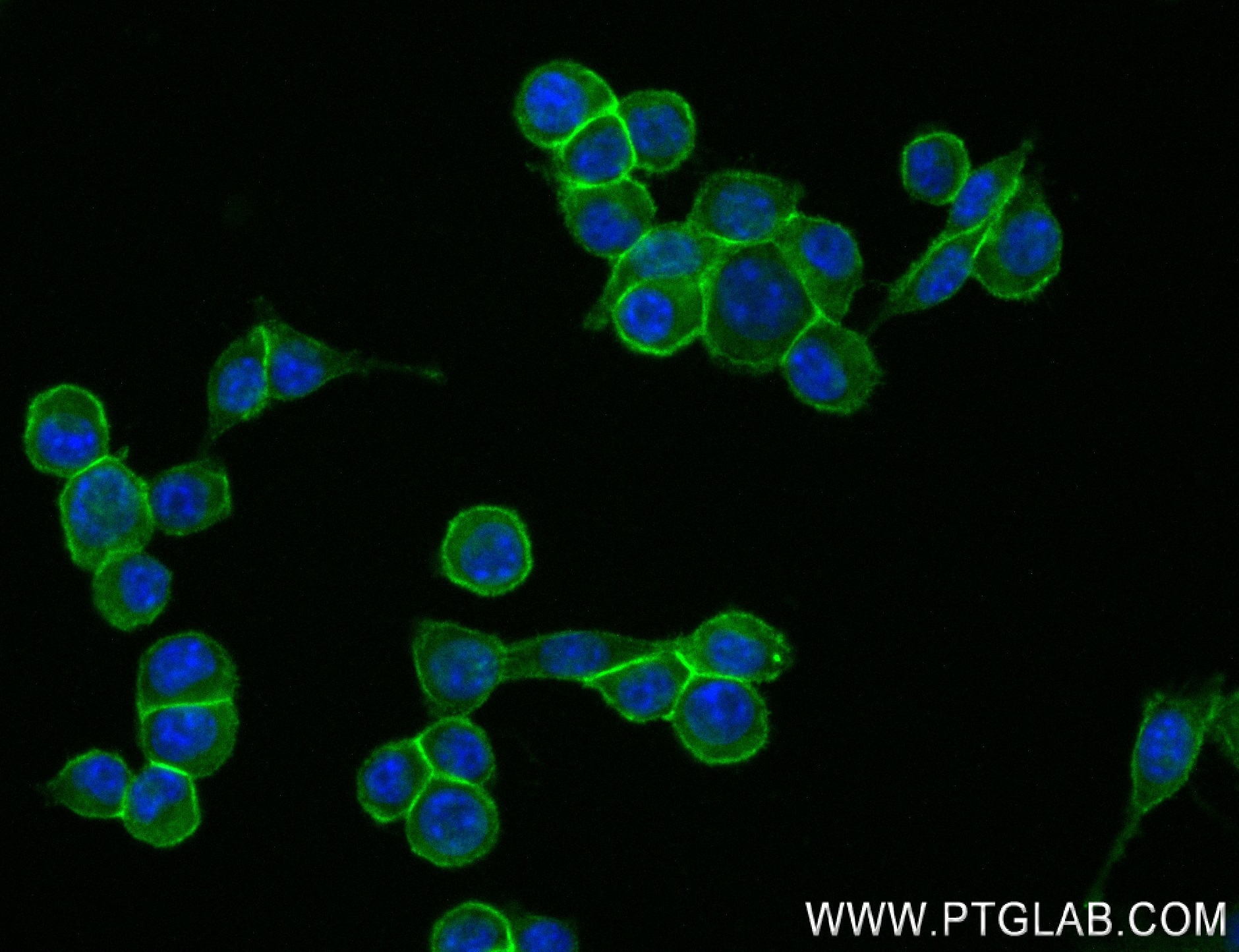 IF Staining of 4T1 using 84128-5-RR