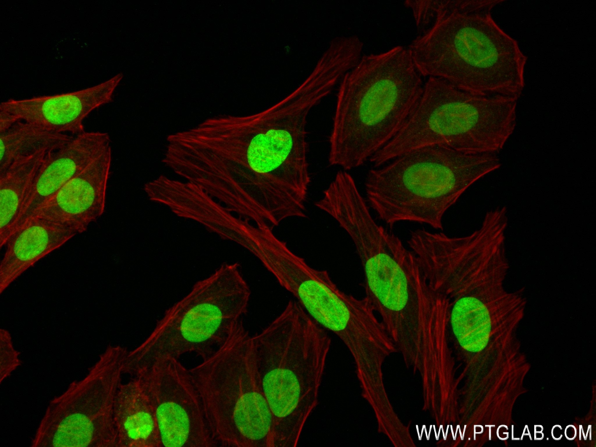 IF Staining of HepG2 using 83993-4-RR