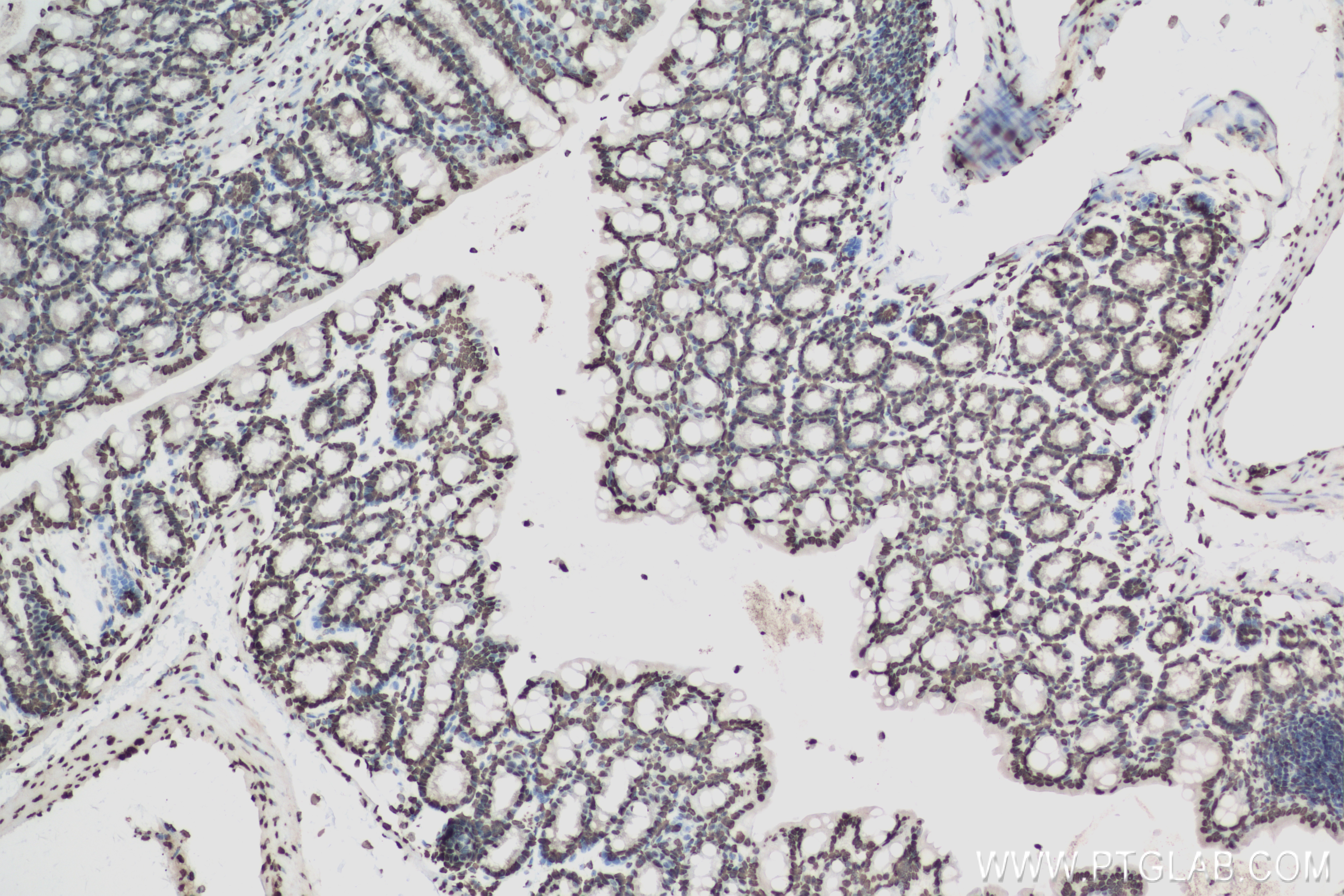 IHC staining of mouse colon using 83993-4-RR