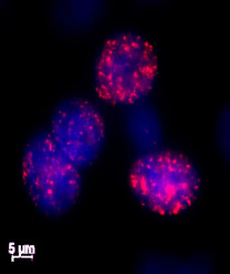 Histone H2AX phospho Ser139 antibody tested by immunofluorescence. Etoposide-treated HeLa cells stained with Cat. No. 39117 (1:500 dilution, red) and counterstained with DAPI (blue).