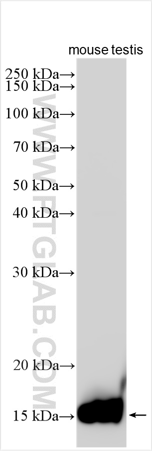 Histone H2B