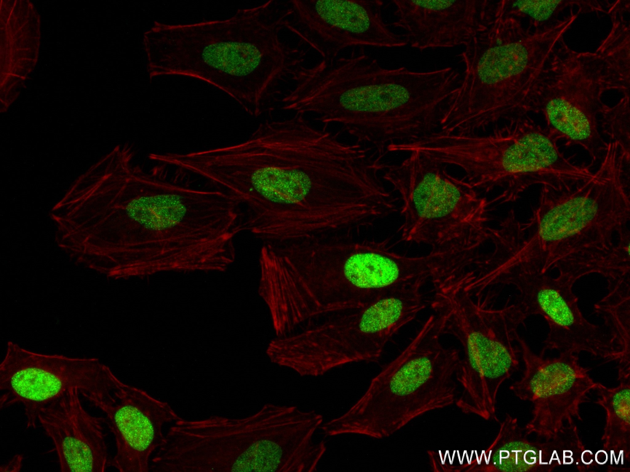 IF Staining of HeLa using 81984-2-RR