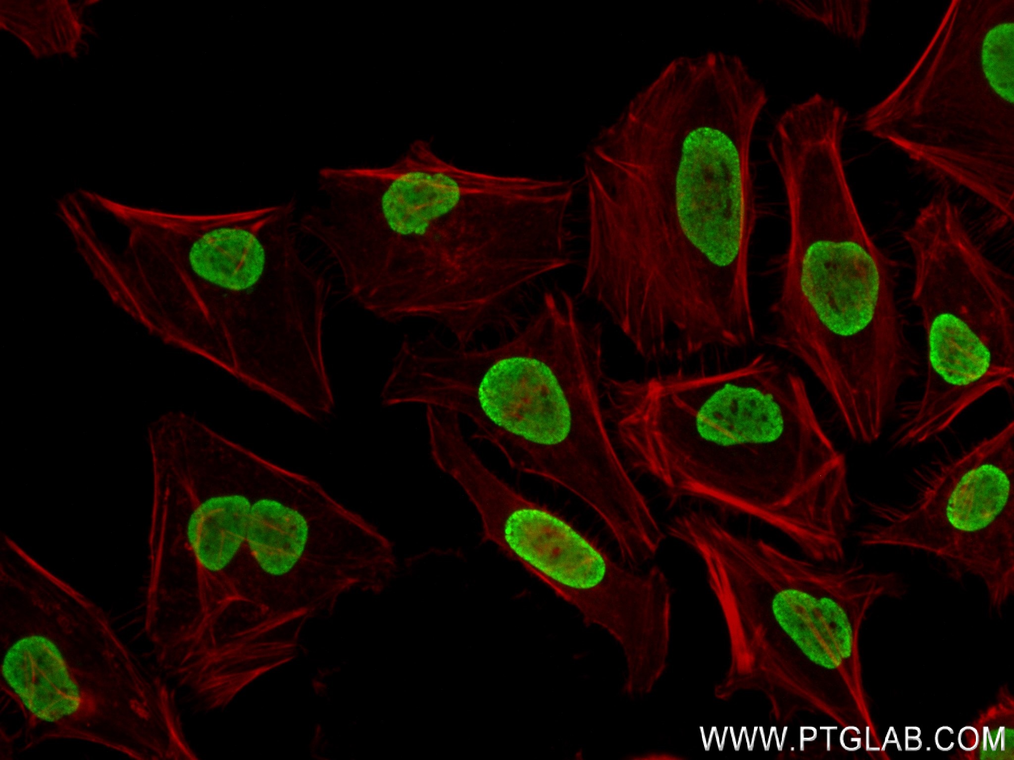 IF Staining of HeLa using 82832-6-RR (same clone as 82832-6-PBS)