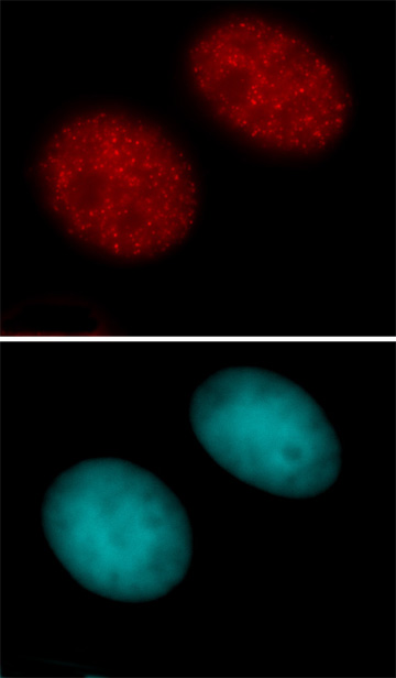 Histone H3 acetyl Lys27 antibody tested by immunofluorescence. Staining of HEK293 cells with Histone H3 acetyl Lys27 antibody (1 ug/ml dilution, top panel) and DAPI (bottom panel).