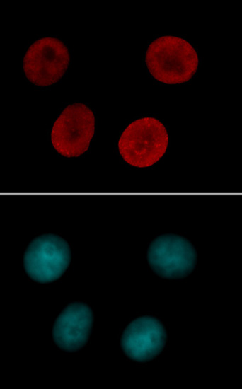 Histone H4 acetyl Lys12 antibody tested by immunofluorescence. Staining of HeLa cells with Histone H4 acetyl Lys12 antibody (1:500 dilution, top panel) and DAPI (bottom panel).