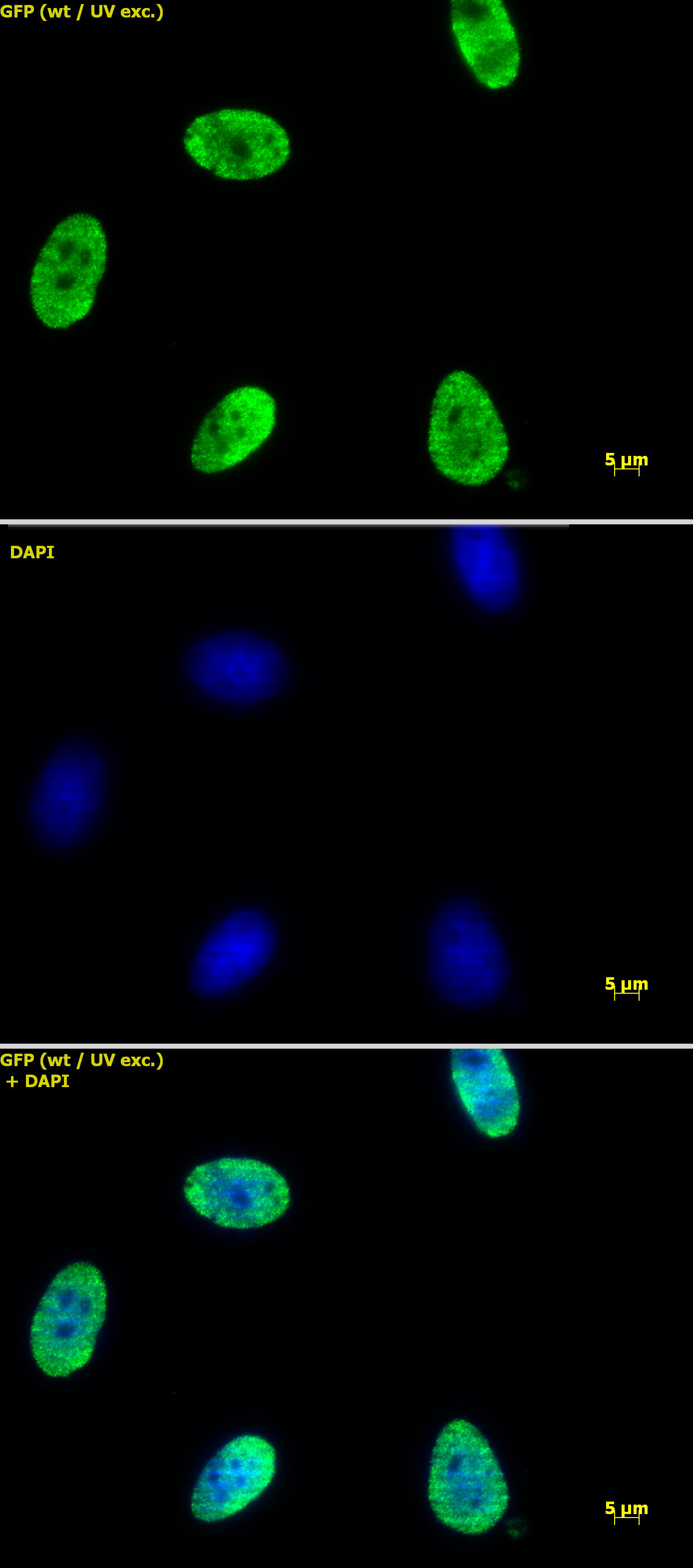 Histone H4 acetyl Lys12 antibody tested by immunofluorescence. HeLa cells stained at 2 ug/ml with Histone H4 acetyl Lys12 antibody. Top panel: Histone H4 acetyl Lys12 antibody. Middle panel: DAPI. Bottom panel: merge.