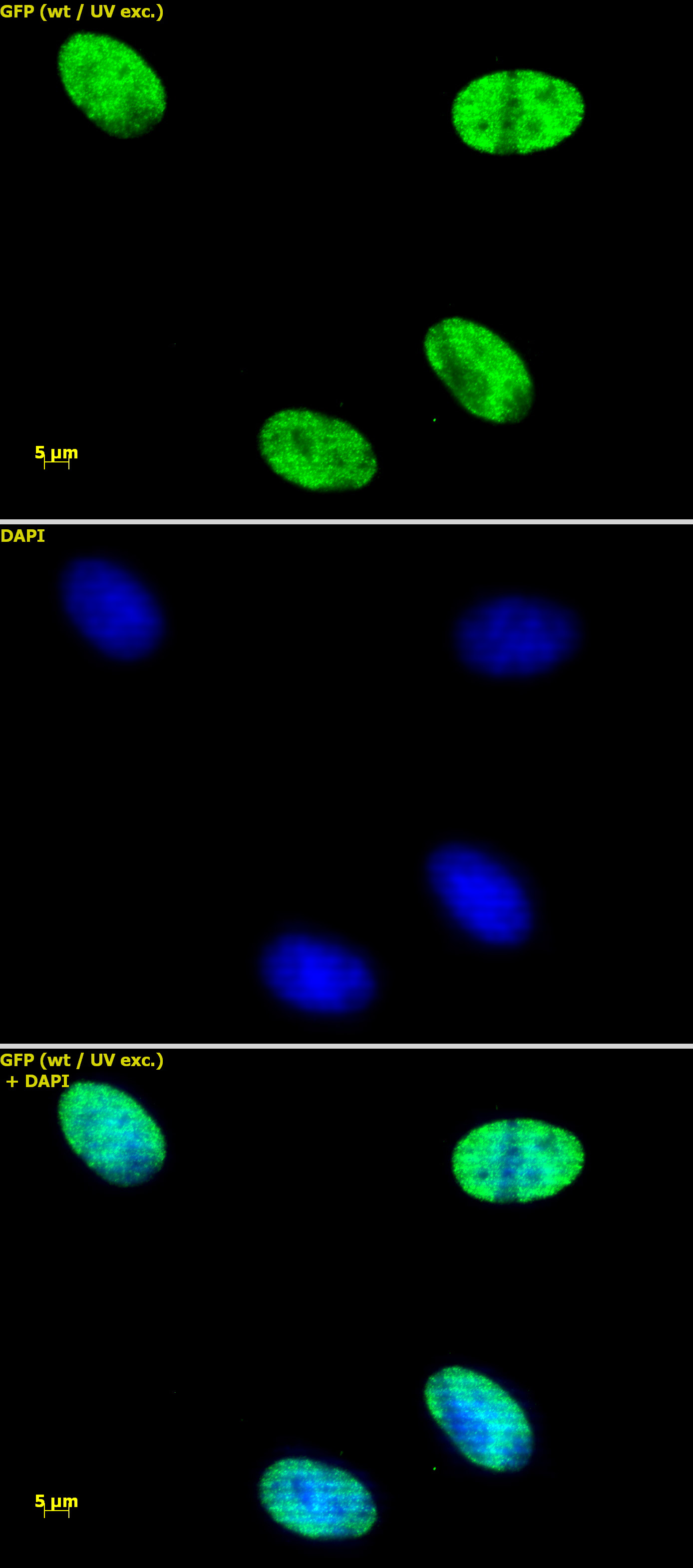 Histone H4ac (pan-acetyl) antibody (pAb) tested by immunofluorescence. HeLa cells stained at 2 ug/ml with Histone H4 pan-acetyl antibody. Top panel: Histone H4 pan-acetyl antibody. Middle panel: DAPI. Bottom panel: merge.