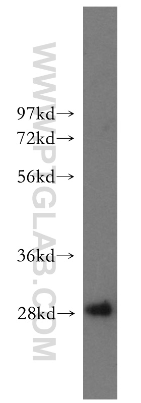 WB analysis of human liver using 51060-1-Ig