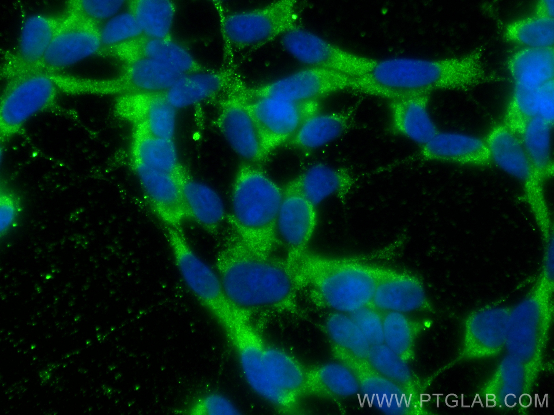 IF Staining of SH-SY5Y using 66553-1-Ig (same clone as 66553-1-PBS)