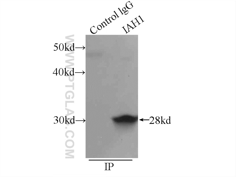 IP experiment of mouse kidney using 17808-1-AP