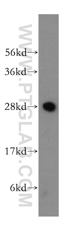 WB analysis of mouse testis using 17808-1-AP