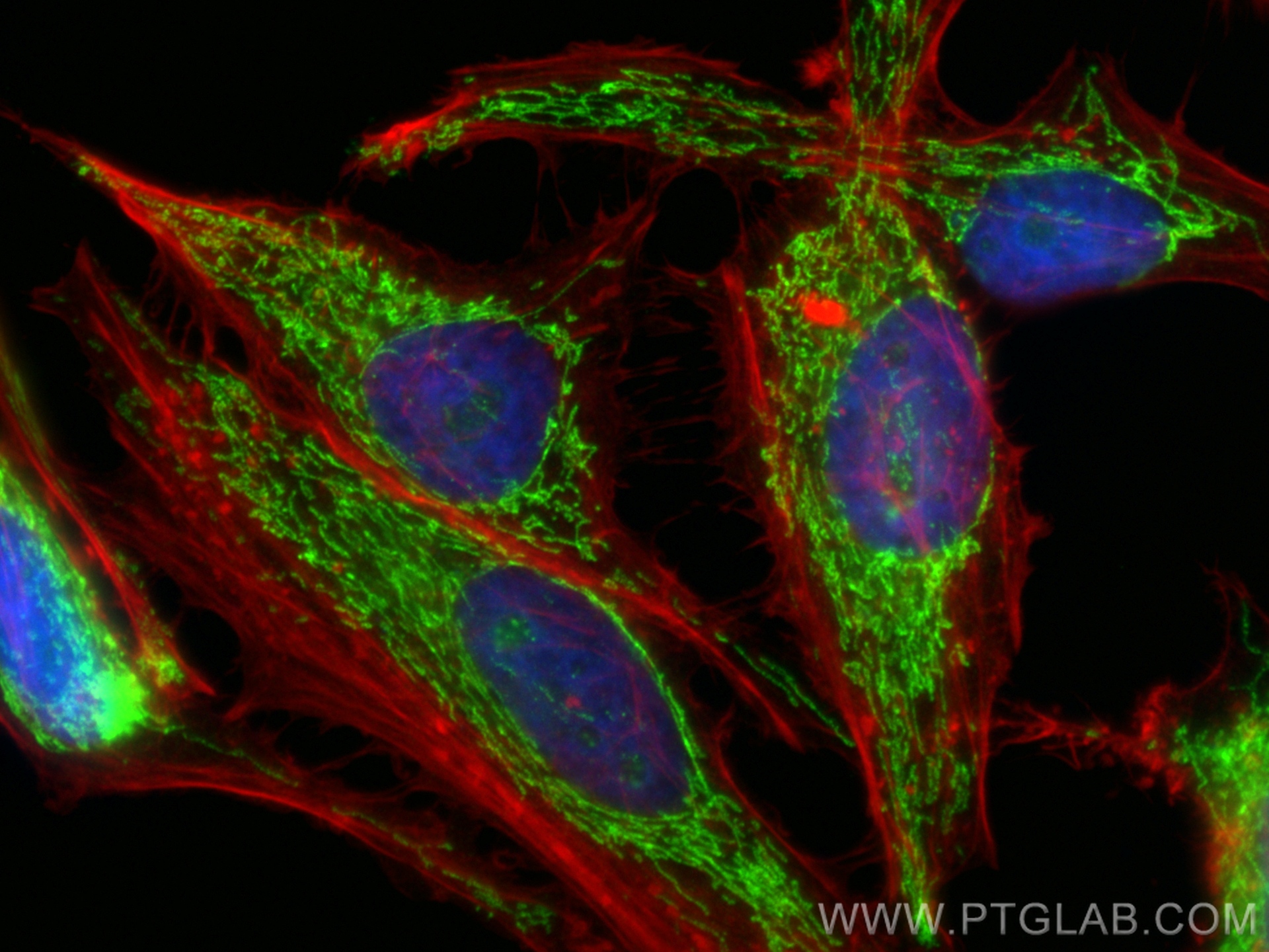 IF Staining of HeLa using 84764-3-RR (same clone as 84764-3-PBS)