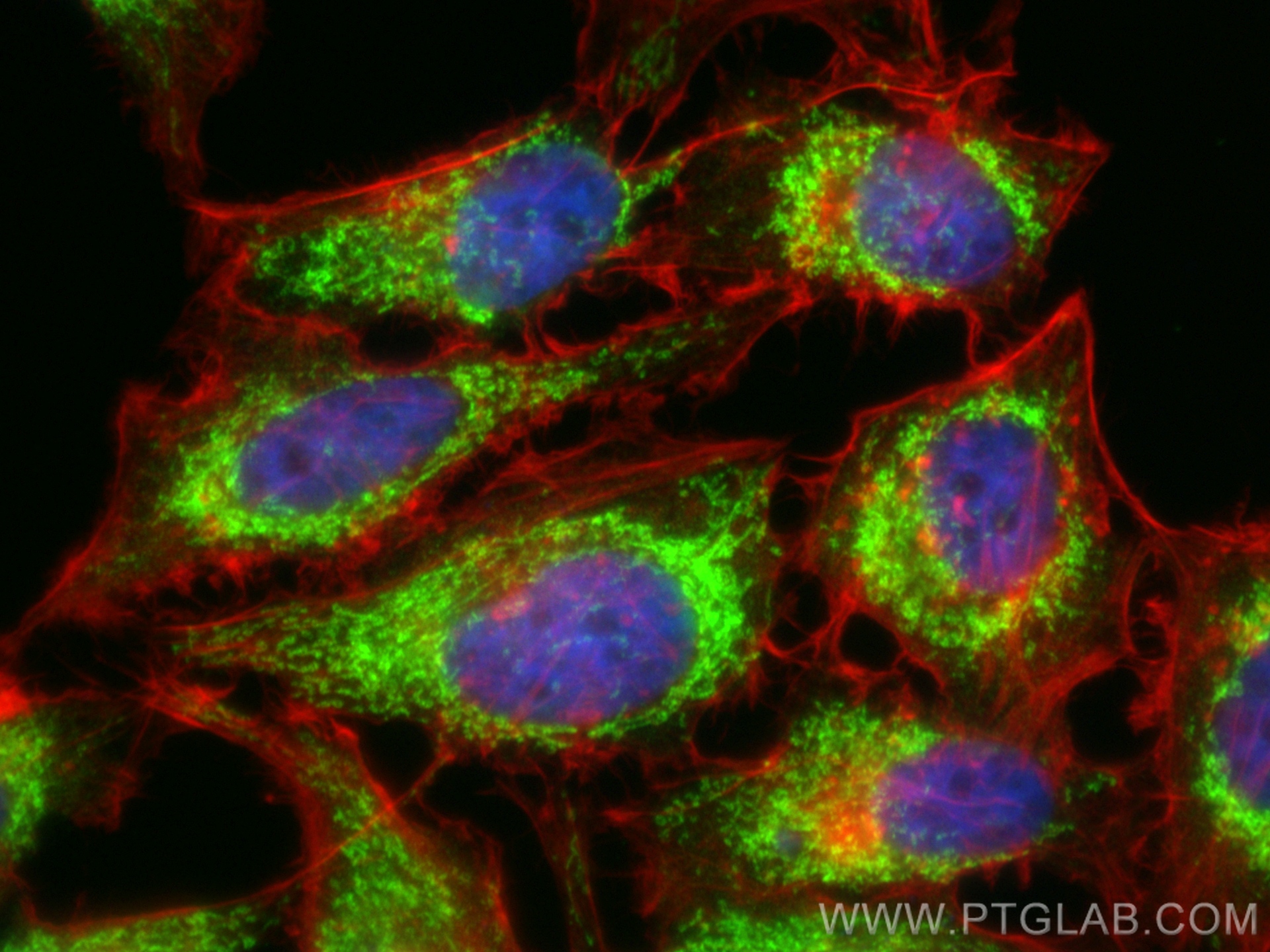 IF Staining of HeLa using 84764-5-RR