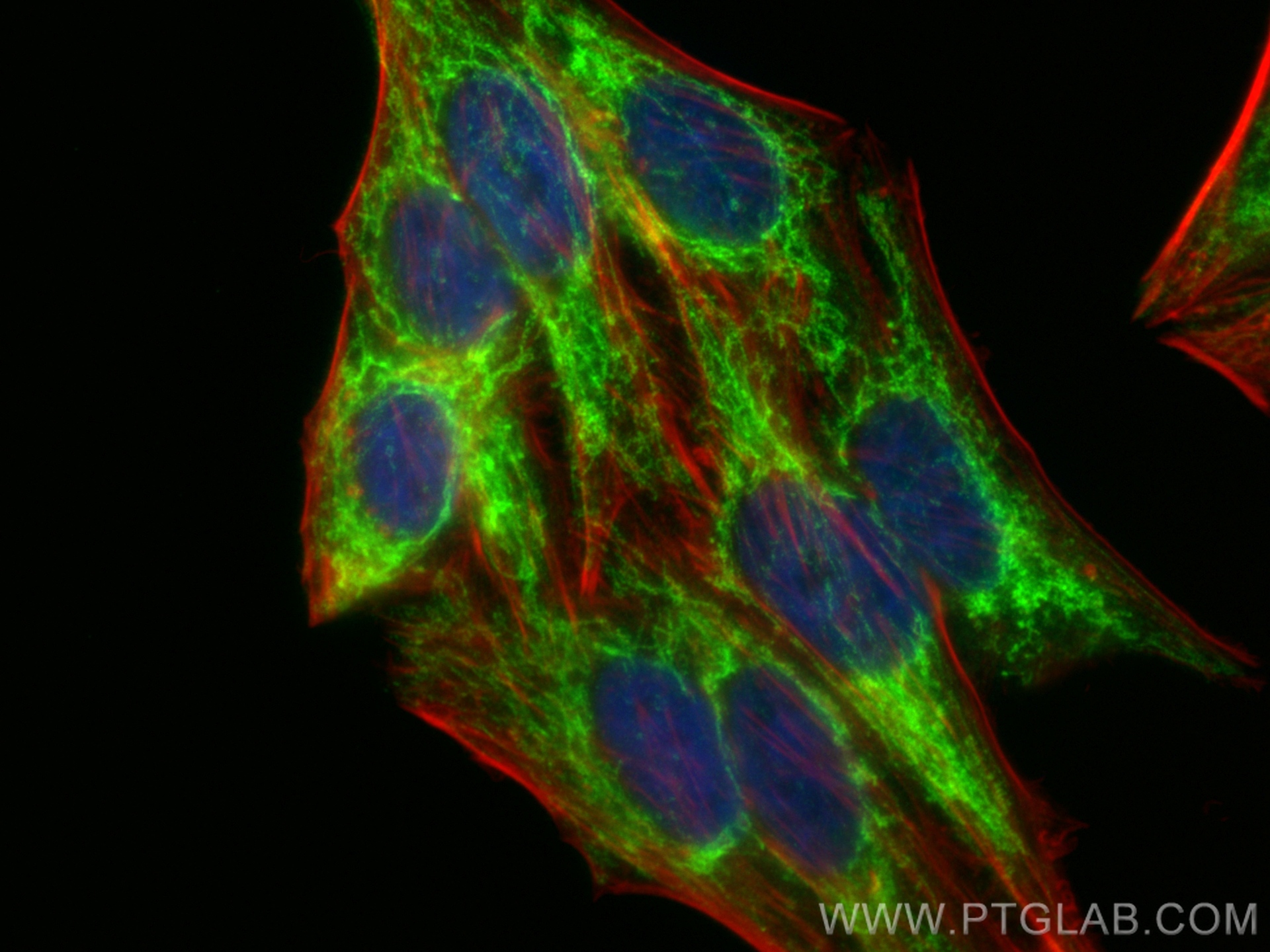 IF Staining of HepG2 using 84764-5-RR