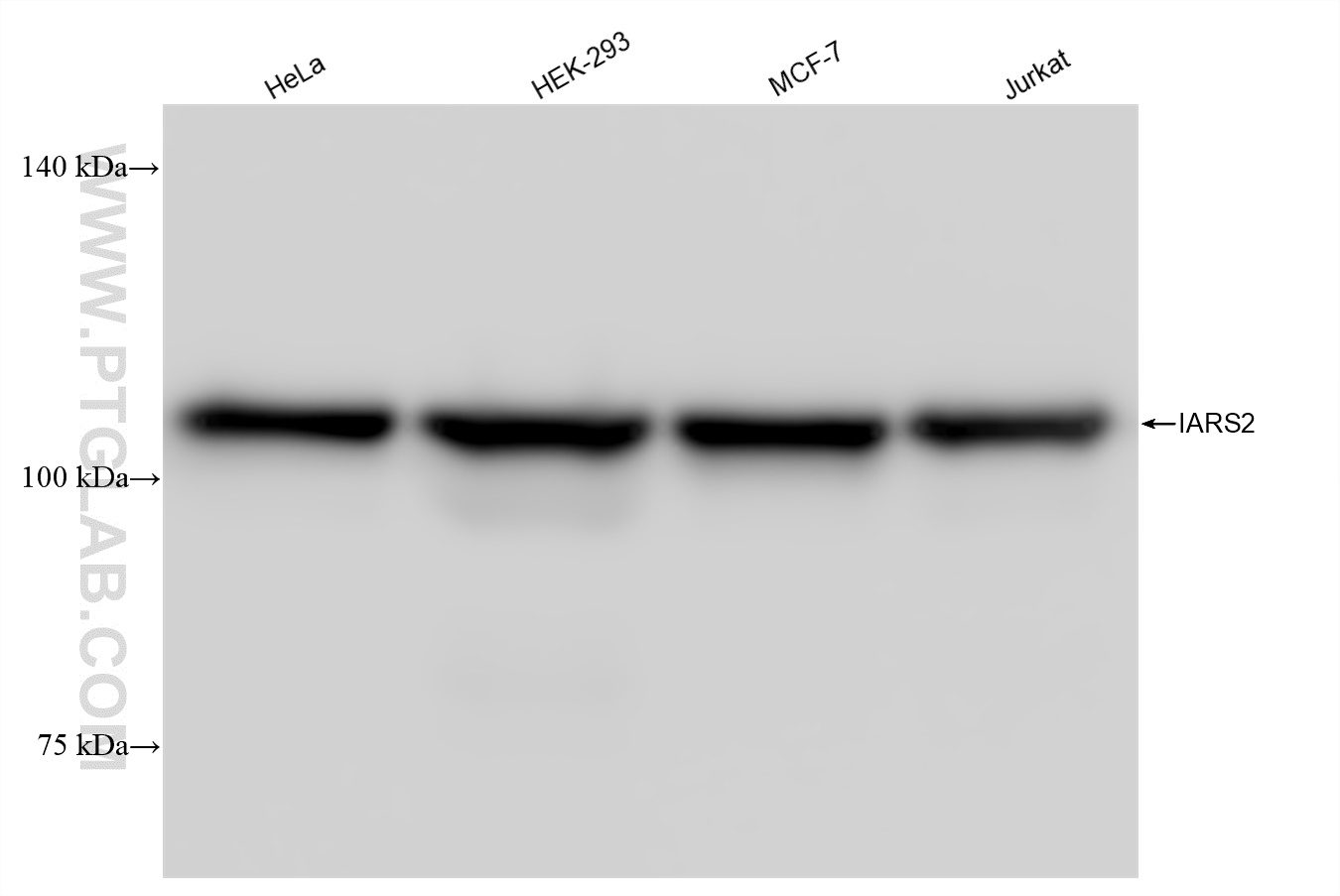 WB analysis using 84764-5-RR (same clone as 84764-5-PBS)