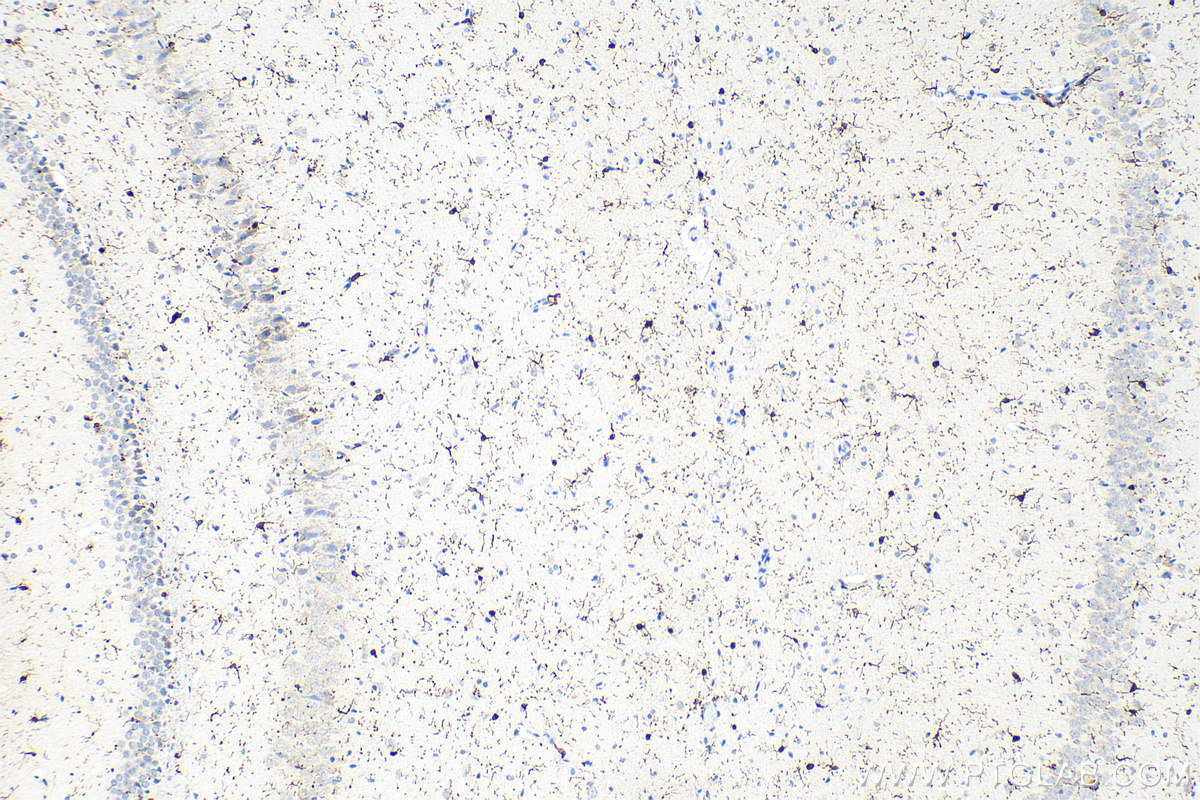 IHC staining of rat brain using 10904-1-AP