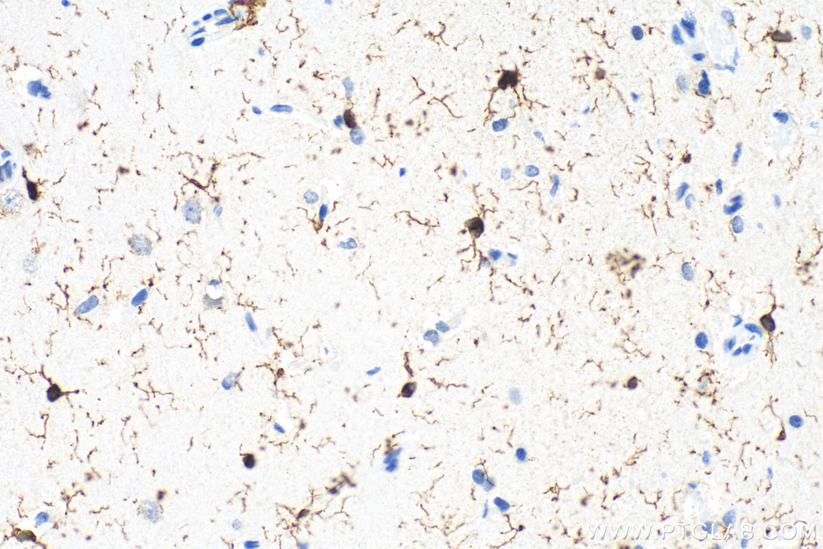 IHC staining of rat brain using 10904-1-AP