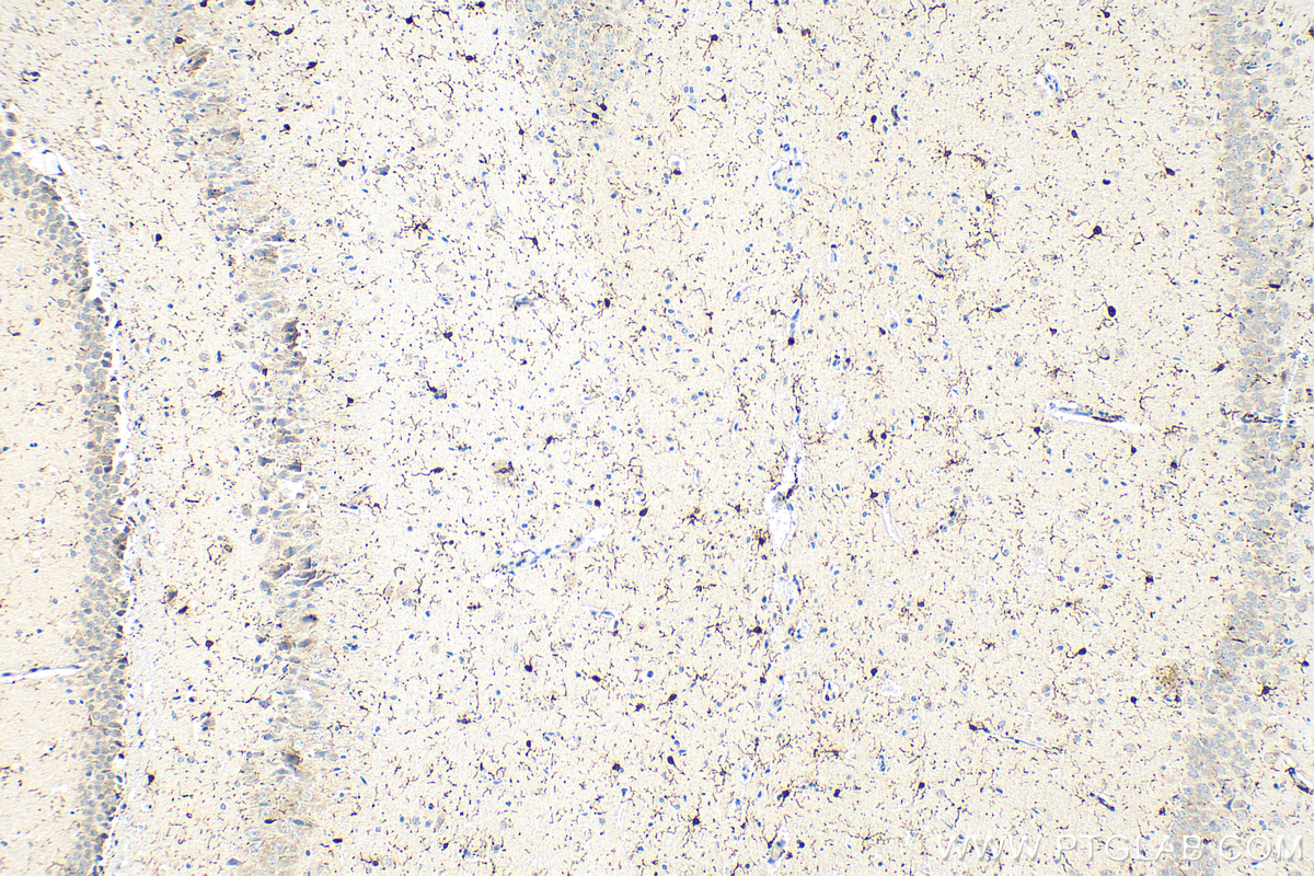 IHC staining of rat brain using 10904-1-AP