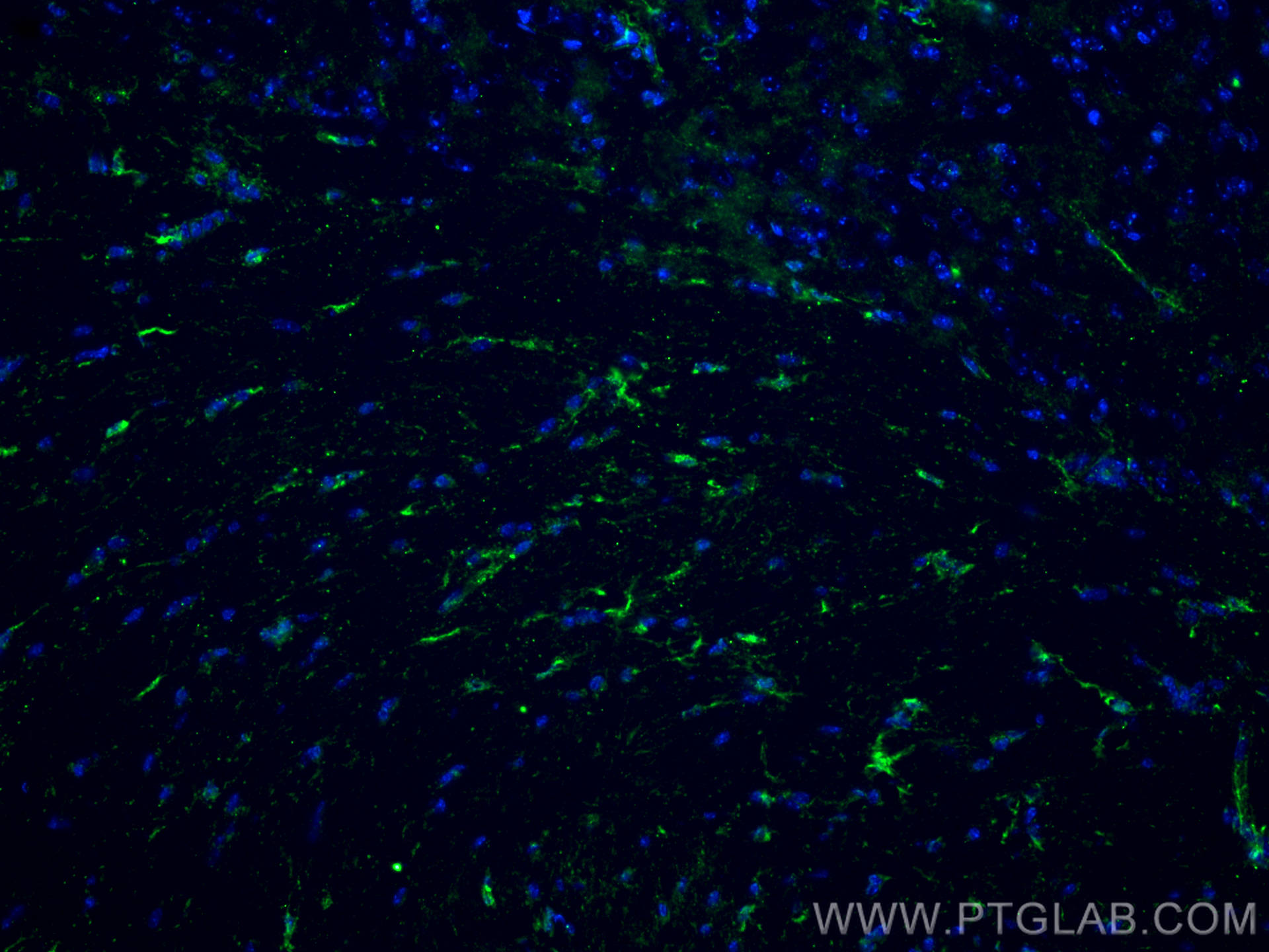 IF Staining of mouse brain using 81728-1-RR (same clone as 81728-1-PBS)