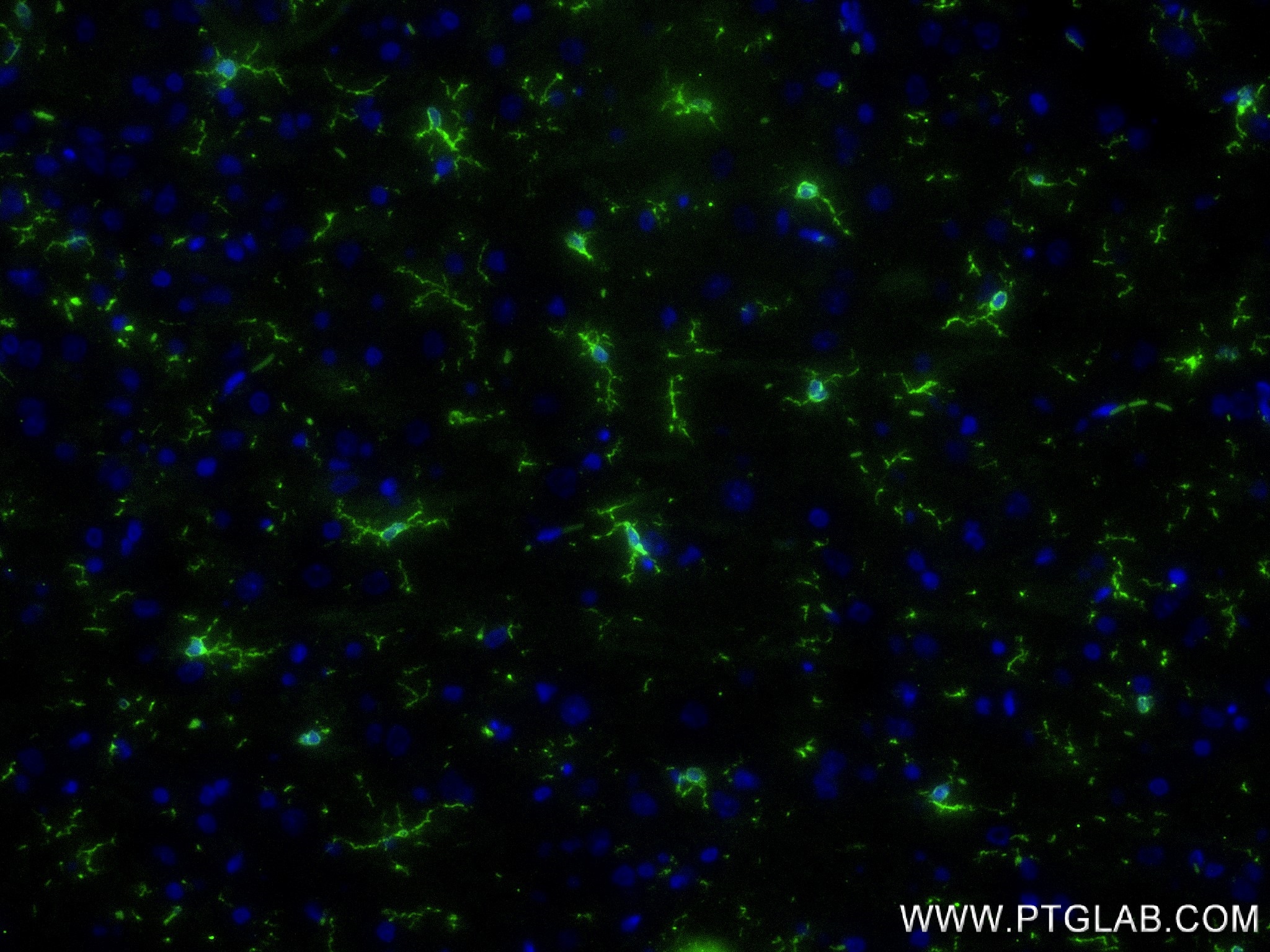 IF Staining of rat brain using 81728-1-RR (same clone as 81728-1-PBS)