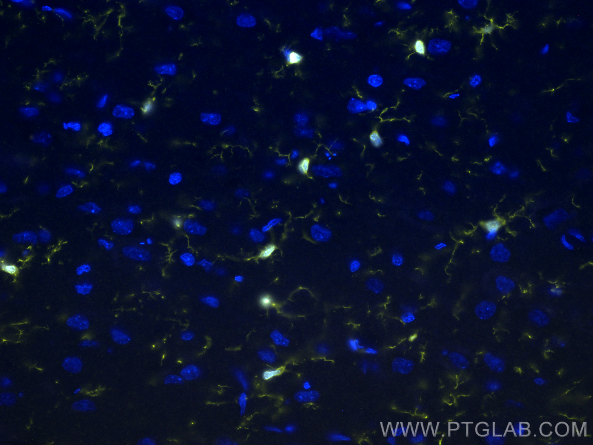 IF Staining of rat brain using CL532-81728