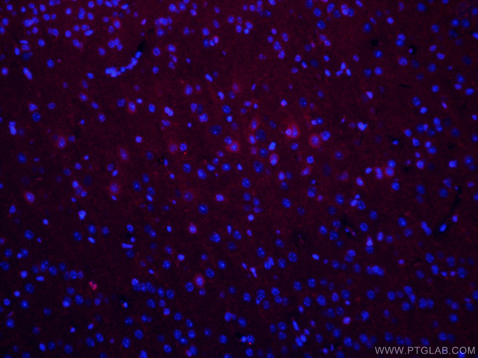 IF Staining of mouse brain using CL594-66827