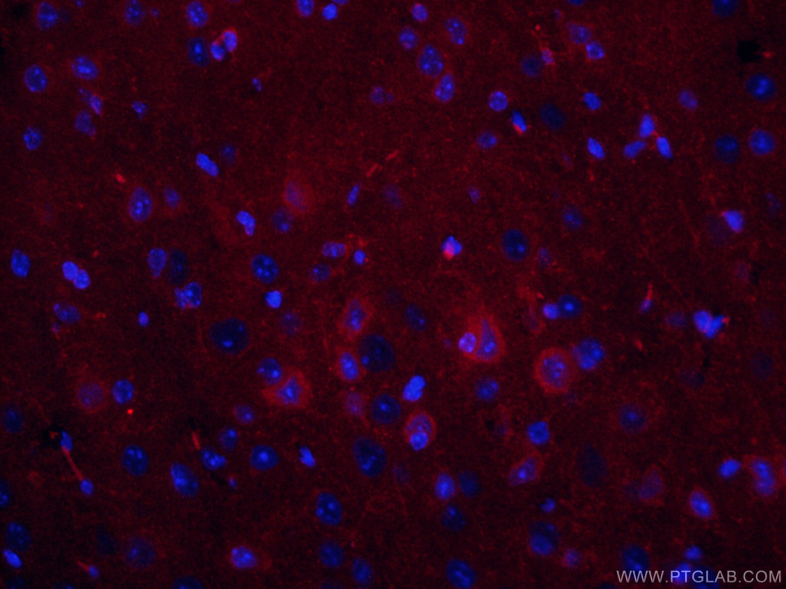 IF Staining of mouse brain using CL594-66827