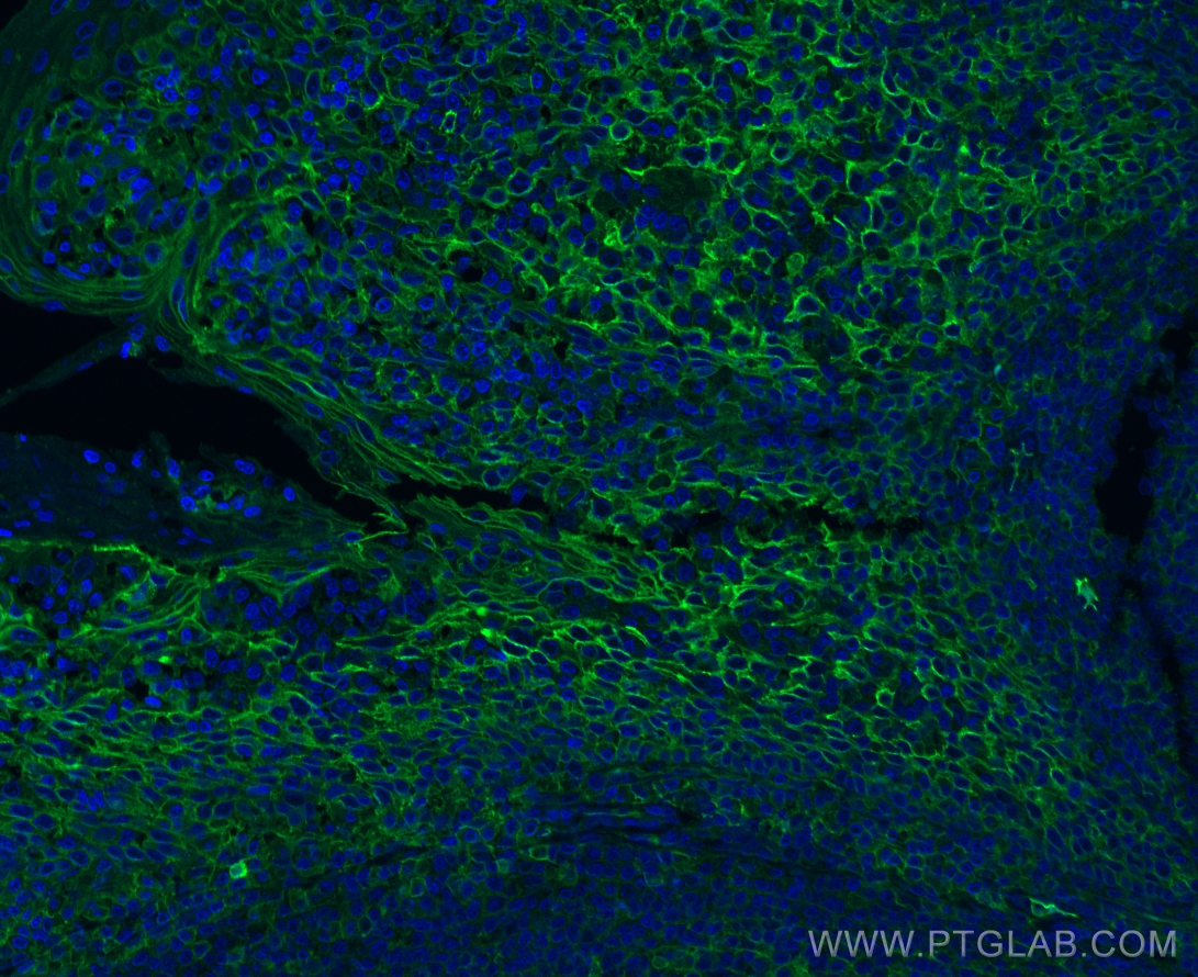 IF Staining of human tonsillitis using 10831-1-AP