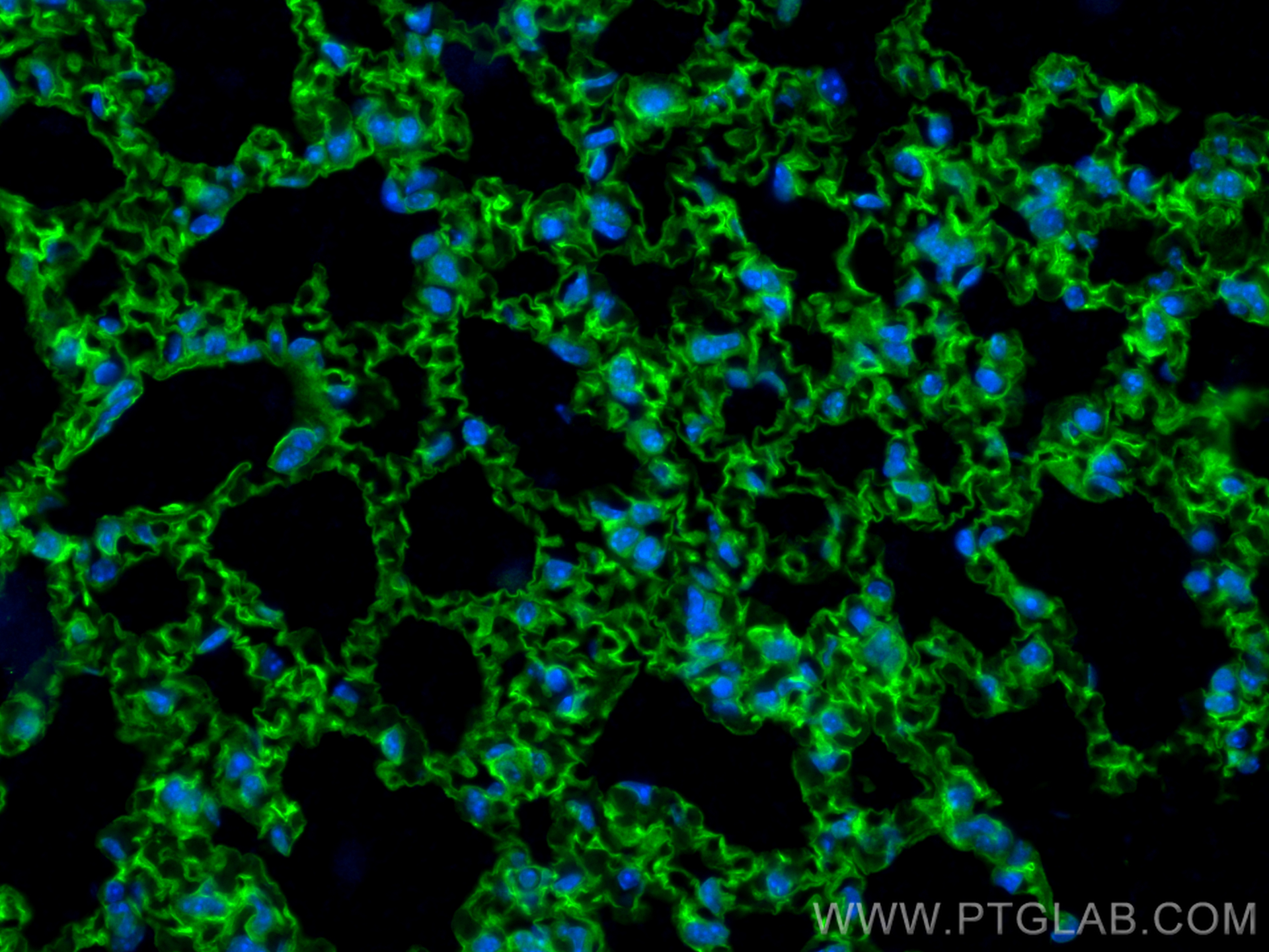 IF Staining of mouse lung using 16174-1-AP