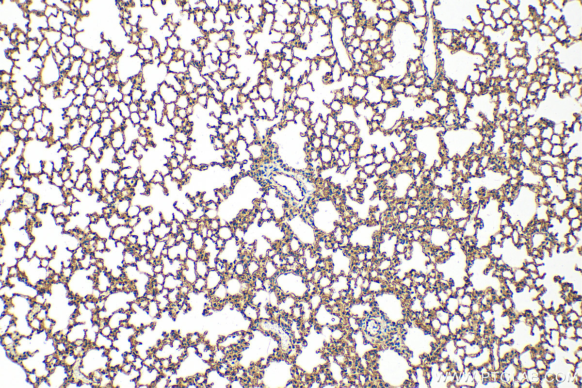 IHC staining of mouse lung using 16174-1-AP