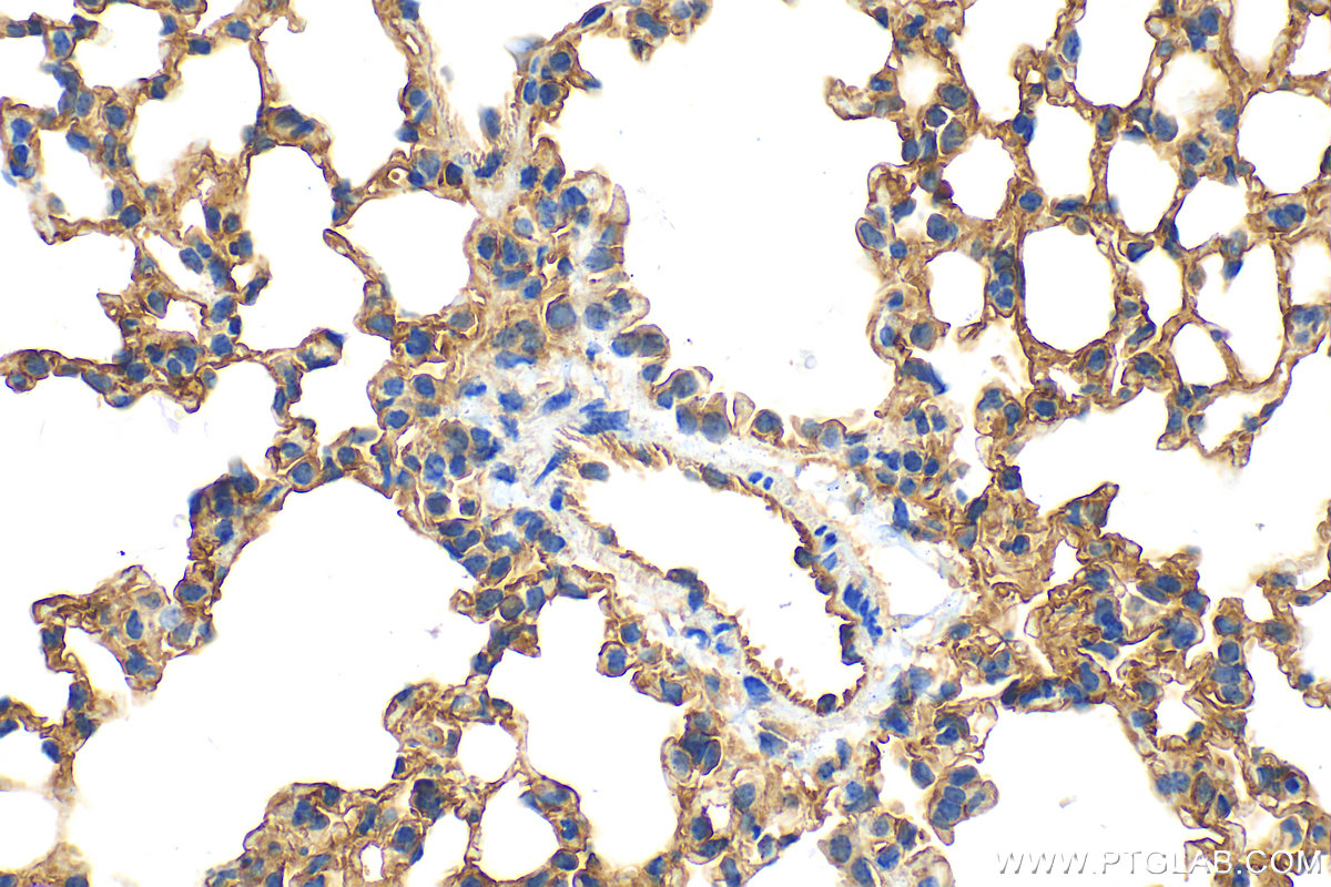 IHC staining of mouse lung using 16174-1-AP