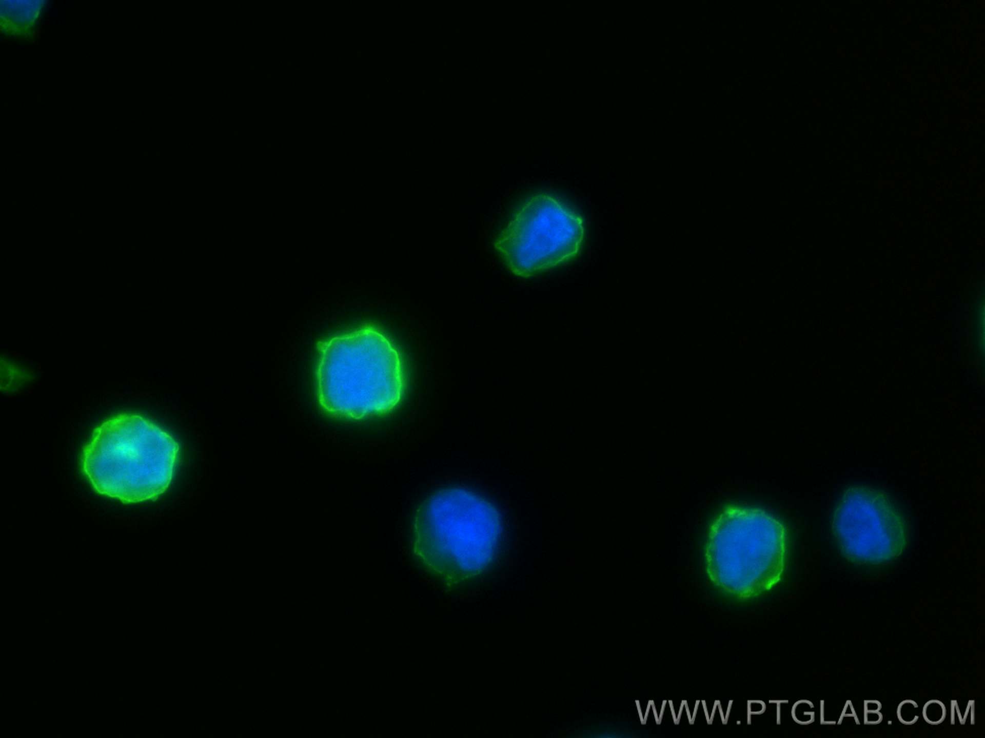 IF Staining of Raji using 30806-1-AP