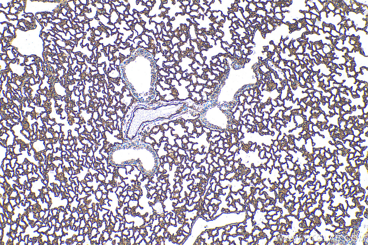 IHC staining of mouse lung using 82827-1-RR