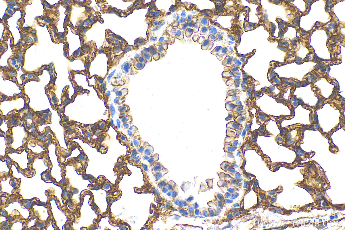 IHC staining of mouse lung using 82827-1-RR