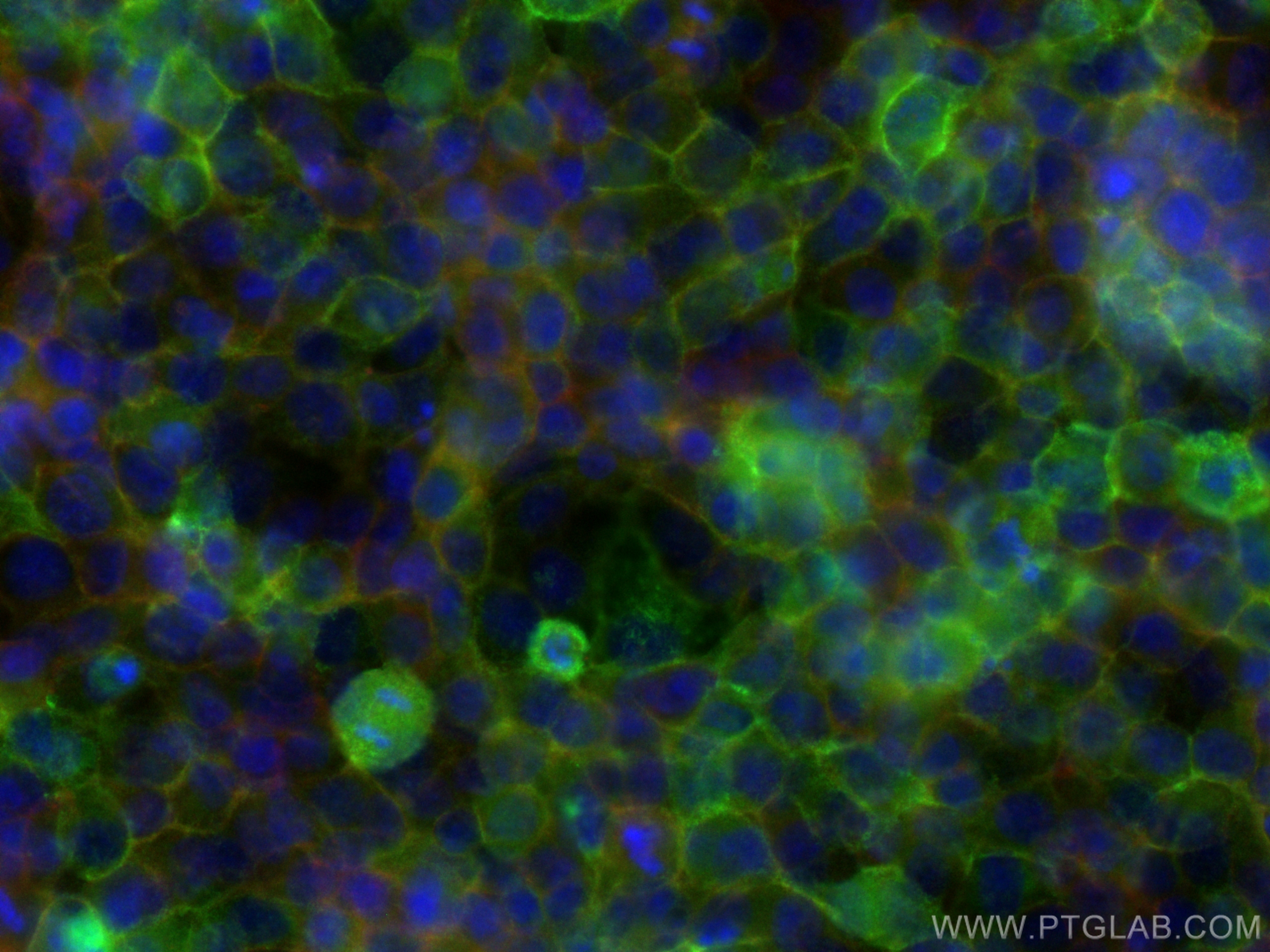 IF Staining of HeLa using 83069-6-RR