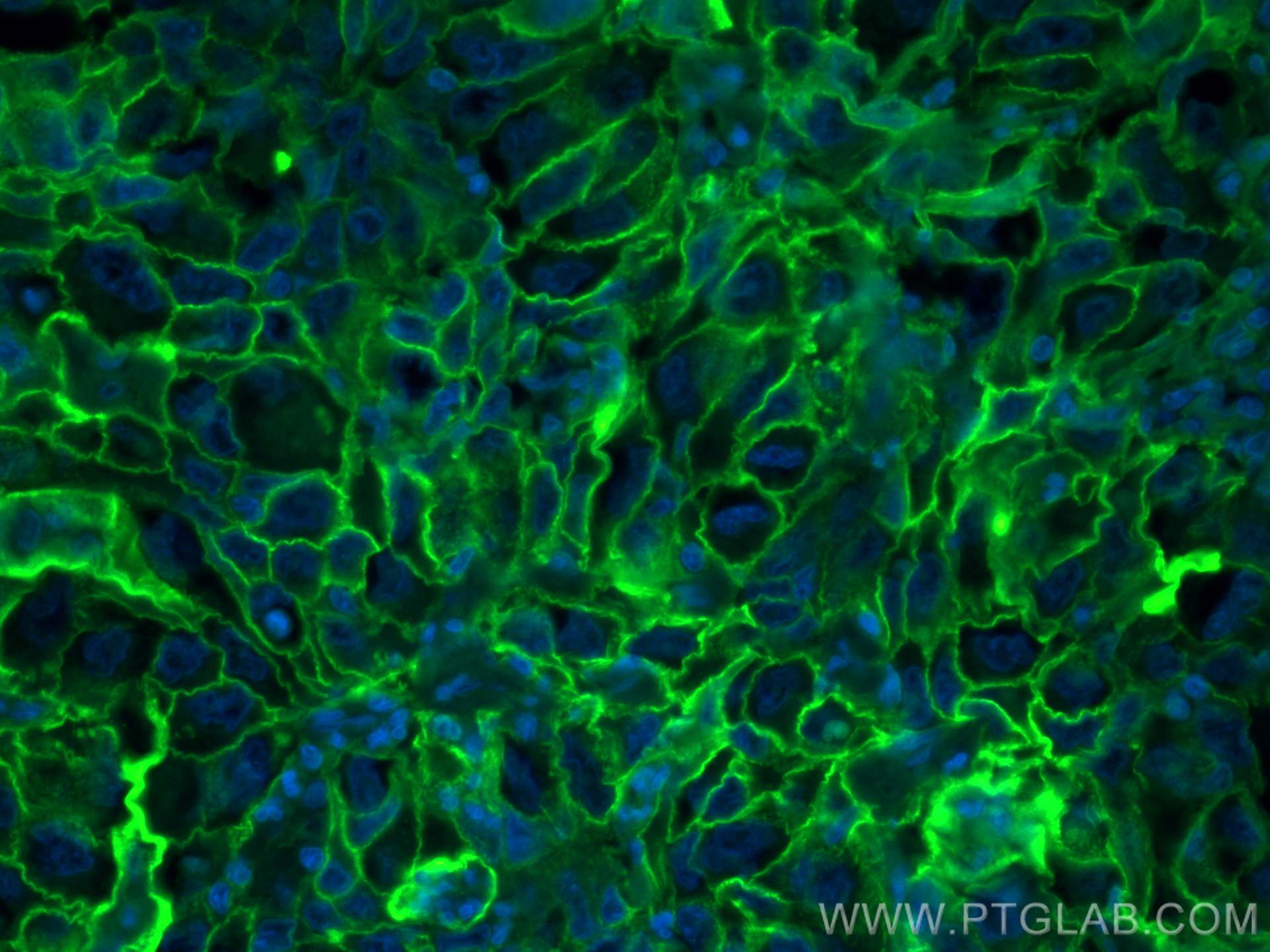 IF Staining of human lung cancer using FITC-60299