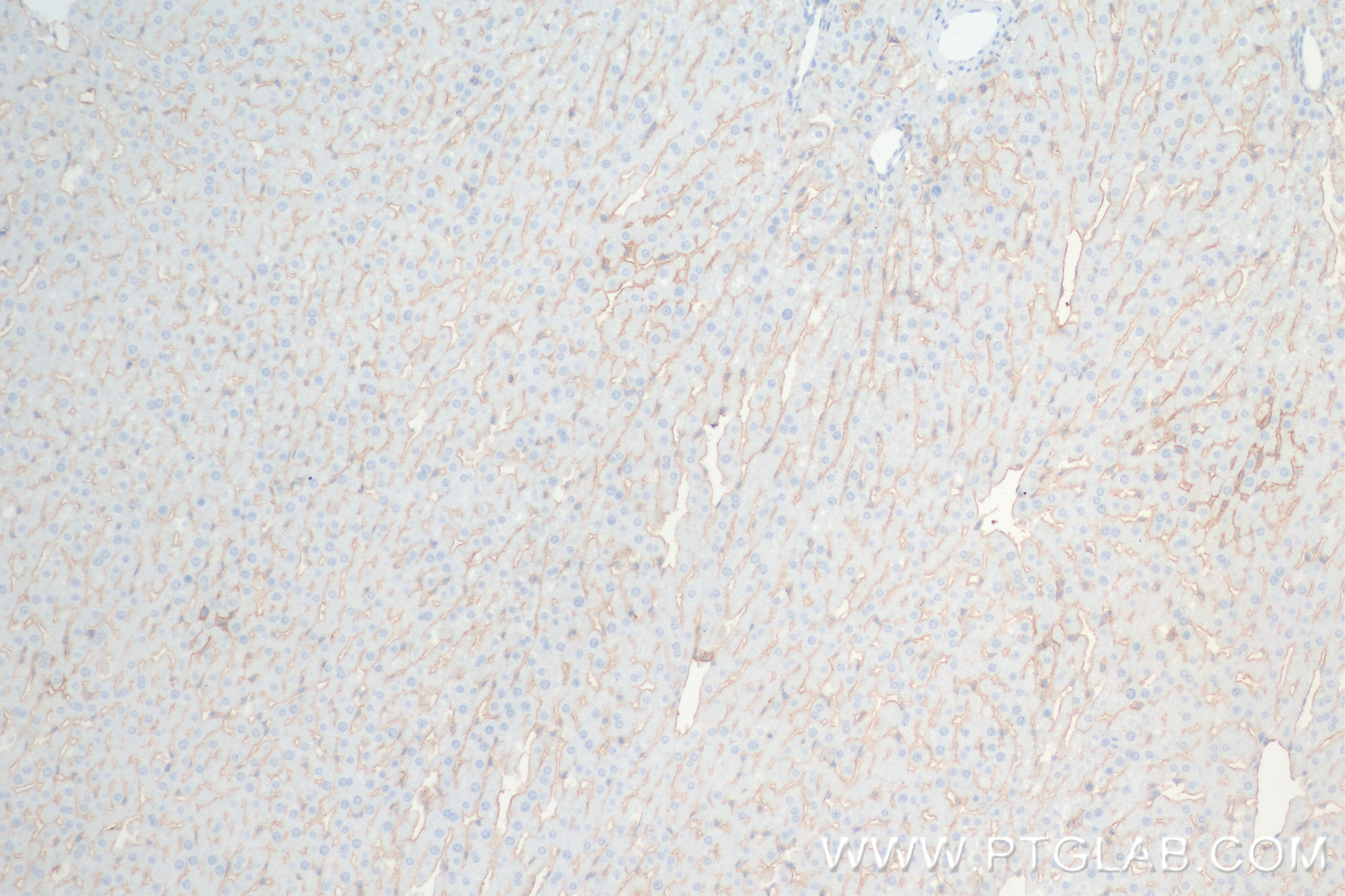 IHC staining of rat liver using 83696-3-RR (same clone as 83696-3-PBS)