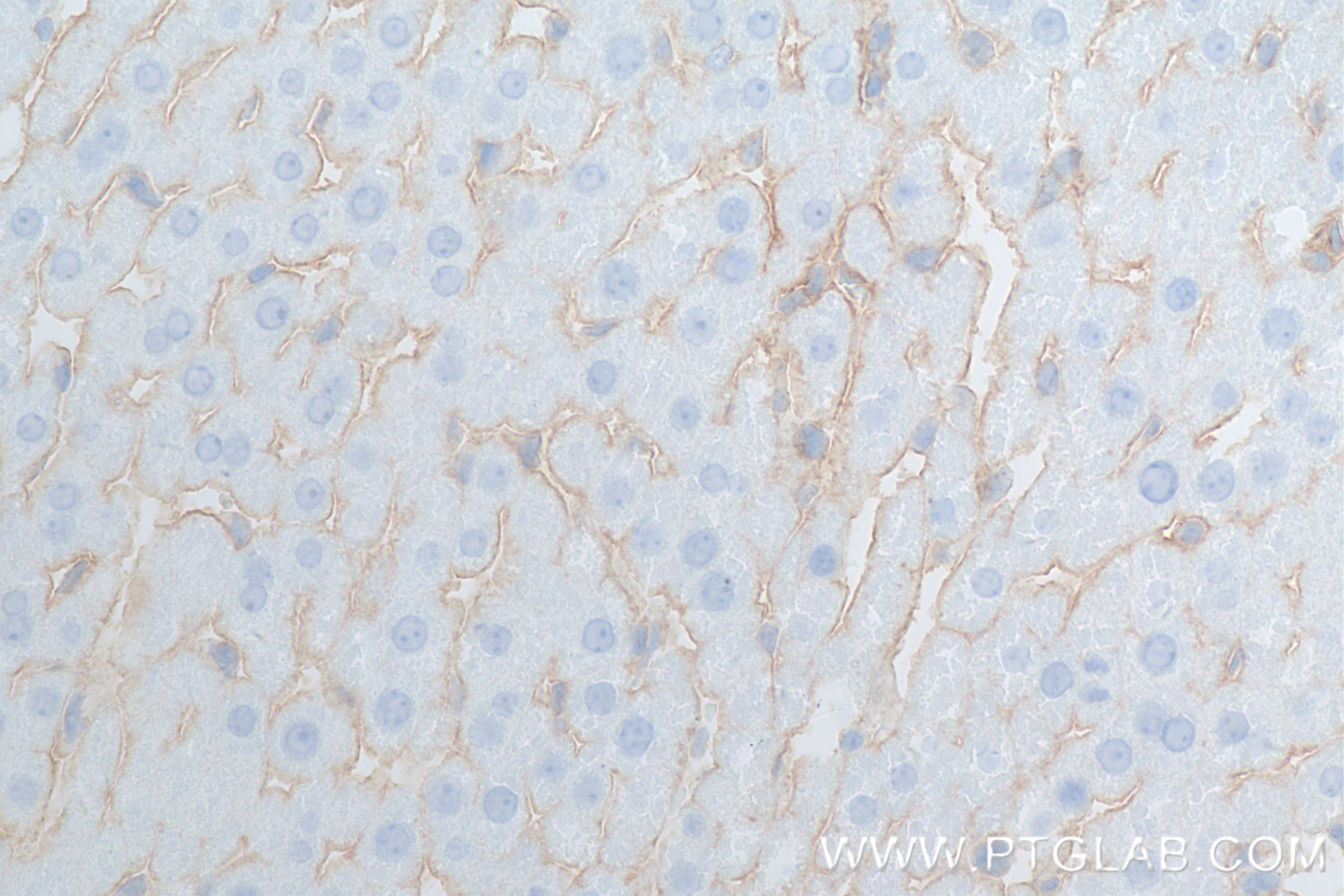 IHC staining of rat liver using 83696-3-RR (same clone as 83696-3-PBS)