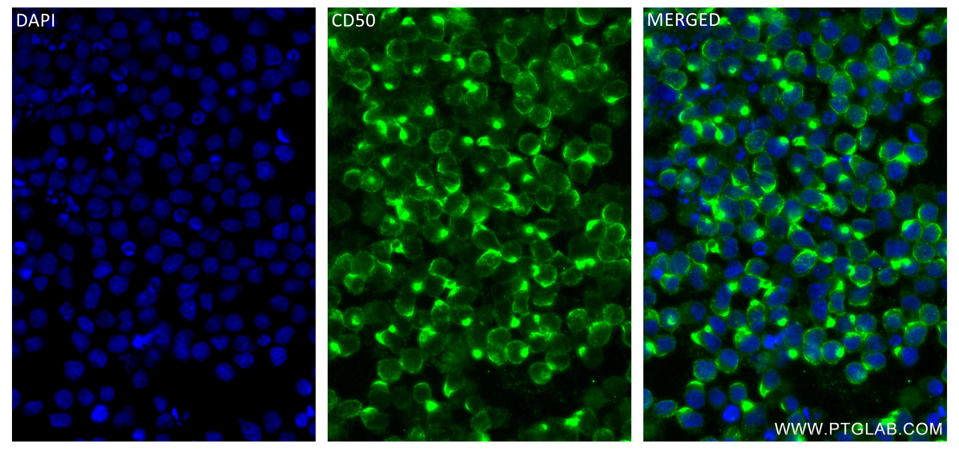 IF Staining of Ramos using 84335-3-RR (same clone as 84335-3-PBS)