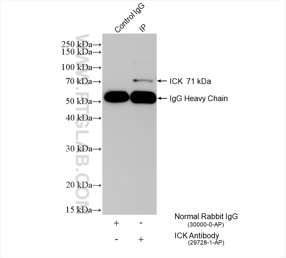 IP experiment of PC-3 using 29728-1-AP