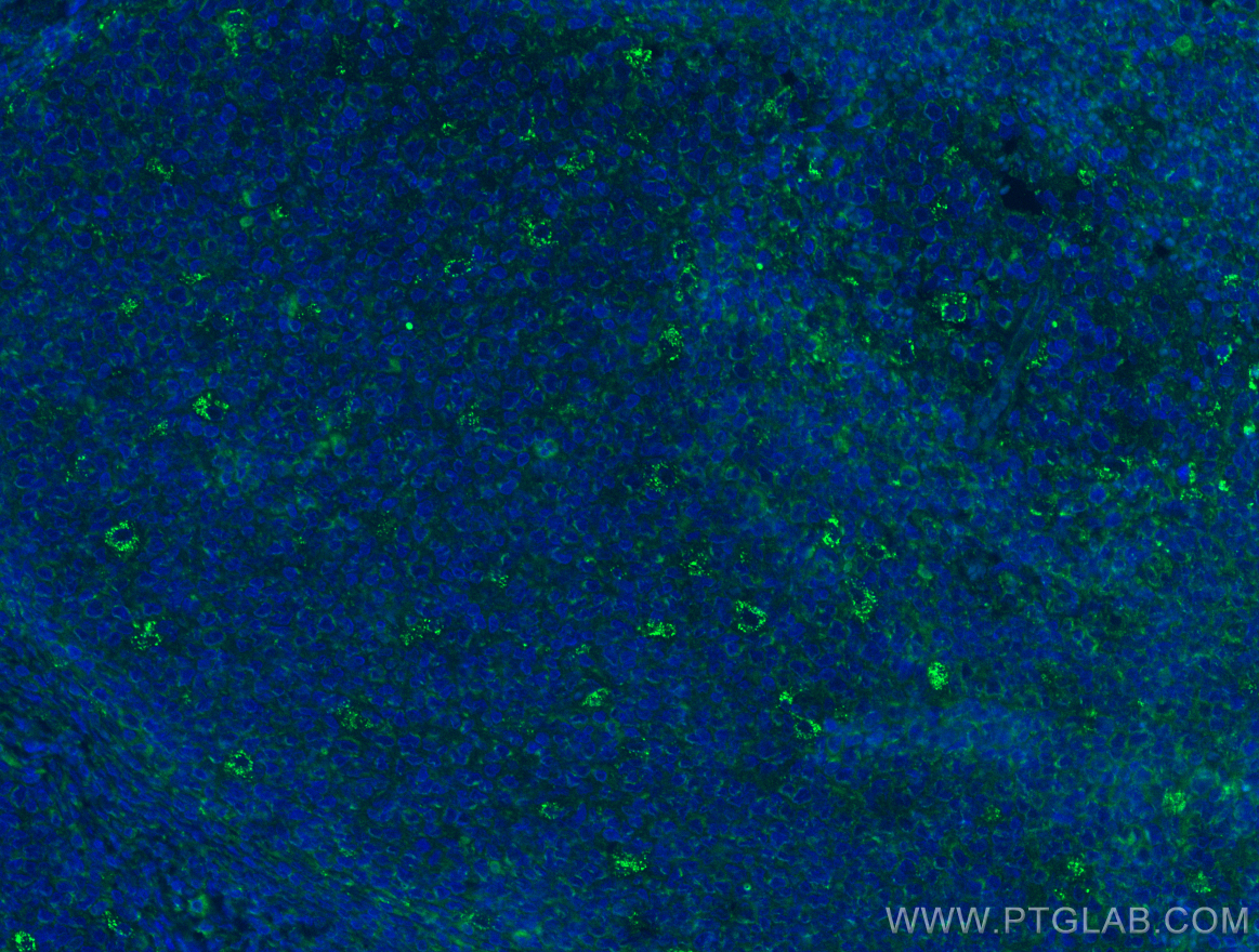 IF Staining of human tonsillitis using 13338-1-AP (same clone as 13338-1-PBS)