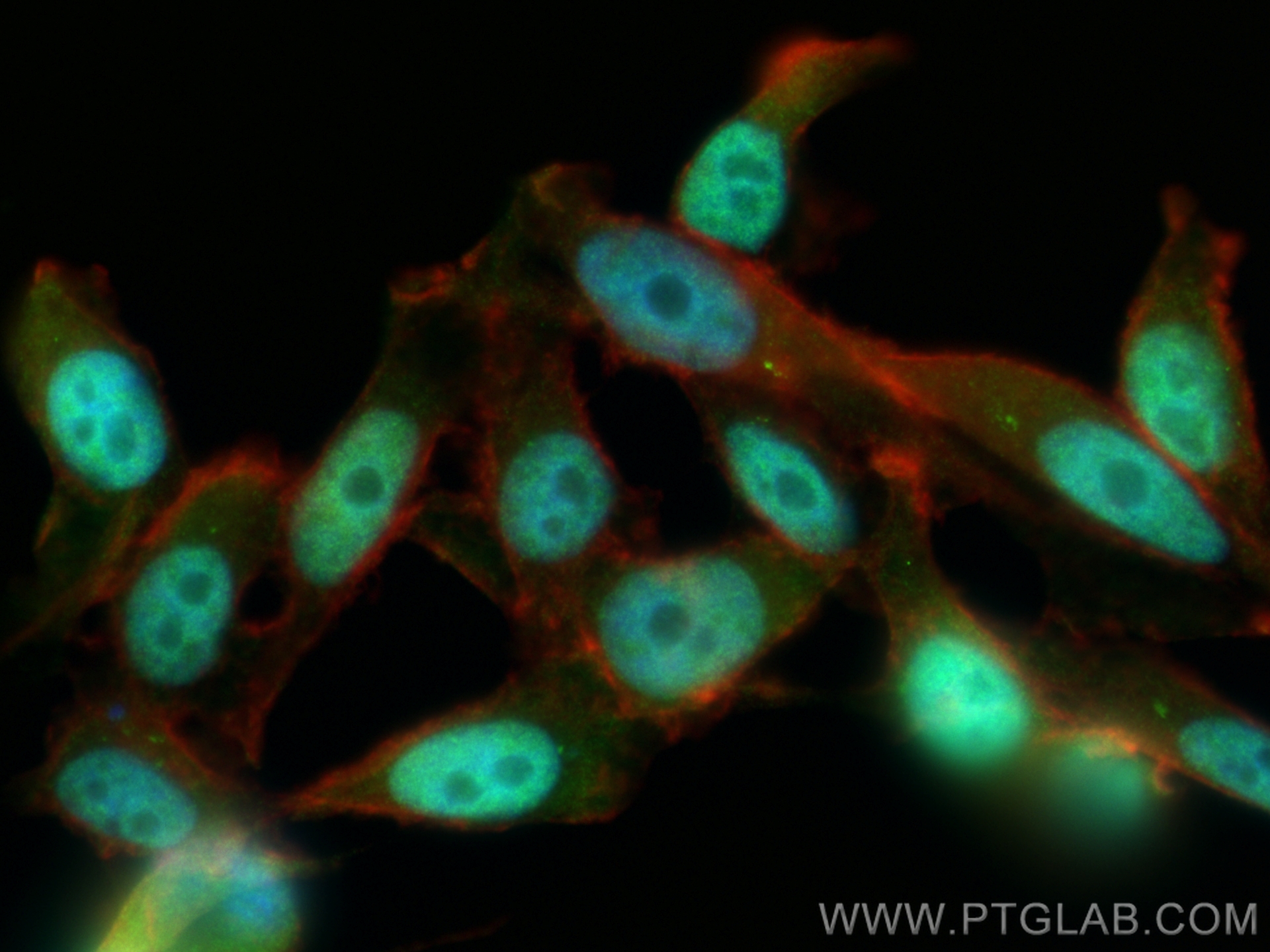 IF Staining of PC-3 using 18475-1-AP