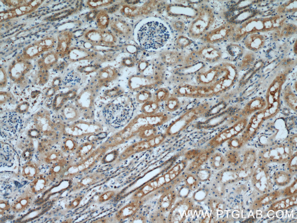 IHC staining of human kidney using 21728-1-AP