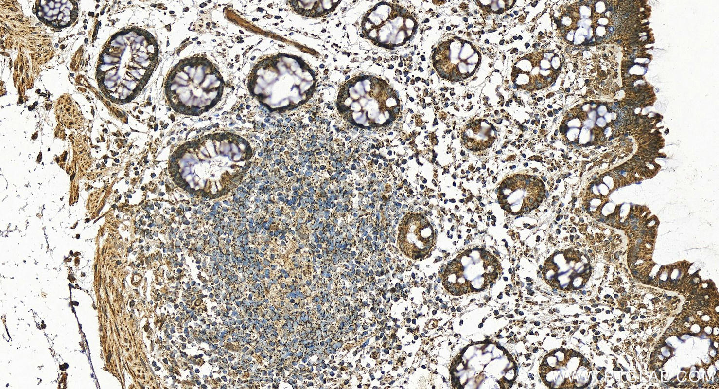 IHC staining of human colon using 25848-1-AP