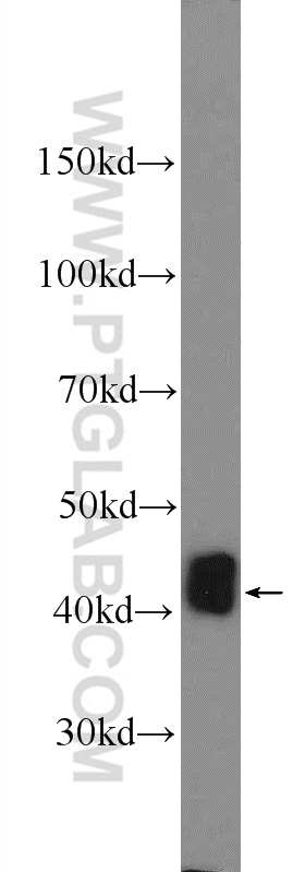 WB analysis of mouse colon using 25848-1-AP