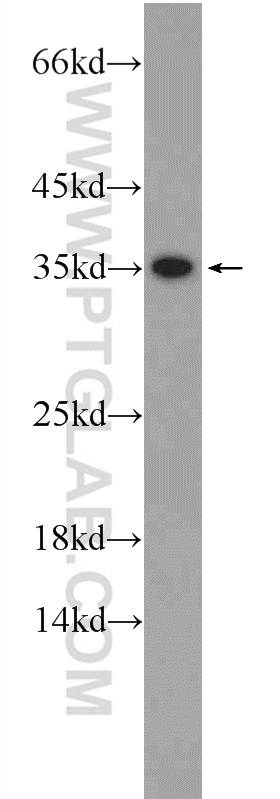 WB analysis of HeLa using 24831-1-AP